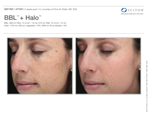 BBL™ + Halo™ Before and After Sciton® Ad